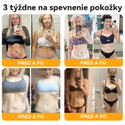 🐝PUROSA® včelí jed Krém na obnovu pokožky🔥🔥 POSLEDNÝ DEŇ 80% ZĽAVA