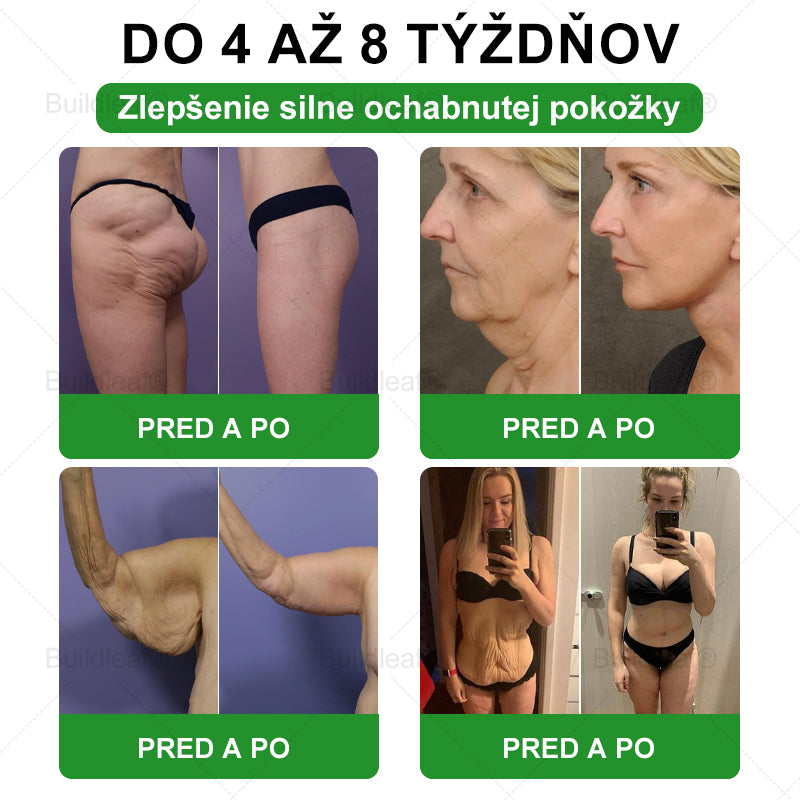 💕BuildLeaf® GLP-1 6-v-1 Fit & Vital Perorálny Roztok ✅ (Len raz denne, viditeľné zmeny už za 7 dní) Pre obezitu, kardiovaskulárne ochorenia, cukrovku, spánkové apnoe, zdravie čriev, problémy s kĺbmi a ďalšie