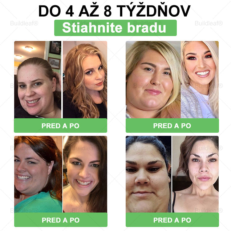 💕BuildLeaf® GLP-1 6-v-1 Fit & Vital Perorálny Roztok ✅ (Len raz denne, viditeľné zmeny už za 7 dní) Pre obezitu, kardiovaskulárne ochorenia, cukrovku, spánkové apnoe, zdravie čriev, problémy s kĺbmi a ďalšie