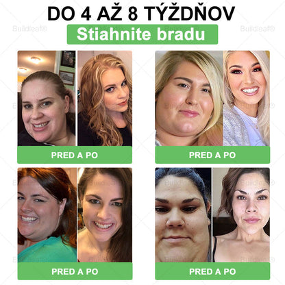 💕BuildLeaf® GLP-1 6-v-1 Fit & Vital Perorálny Roztok ✅ (Len raz denne, viditeľné zmeny už za 7 dní) Pre obezitu, kardiovaskulárne ochorenia, cukrovku, spánkové apnoe, zdravie čriev, problémy s kĺbmi a ďalšie