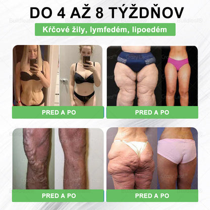 💕BuildLeaf® GLP-1 6-v-1 Fit & Vital Perorálny Roztok ✅ (Len raz denne, viditeľné zmeny už za 7 dní) Pre obezitu, kardiovaskulárne ochorenia, cukrovku, spánkové apnoe, zdravie čriev, problémy s kĺbmi a ďalšie